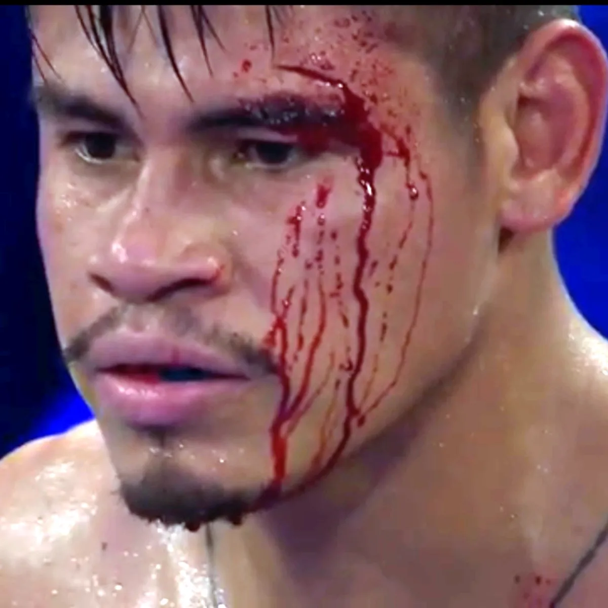 NavarreteSuarezResultadoTR-1