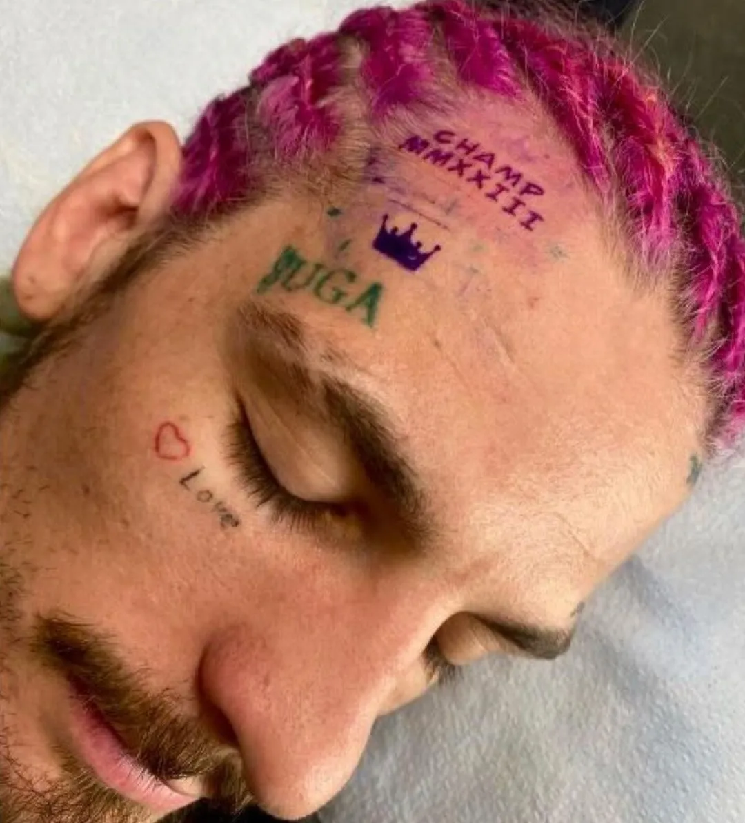 El deslucido tatuaje con el que O'Malley celebra ser campeón