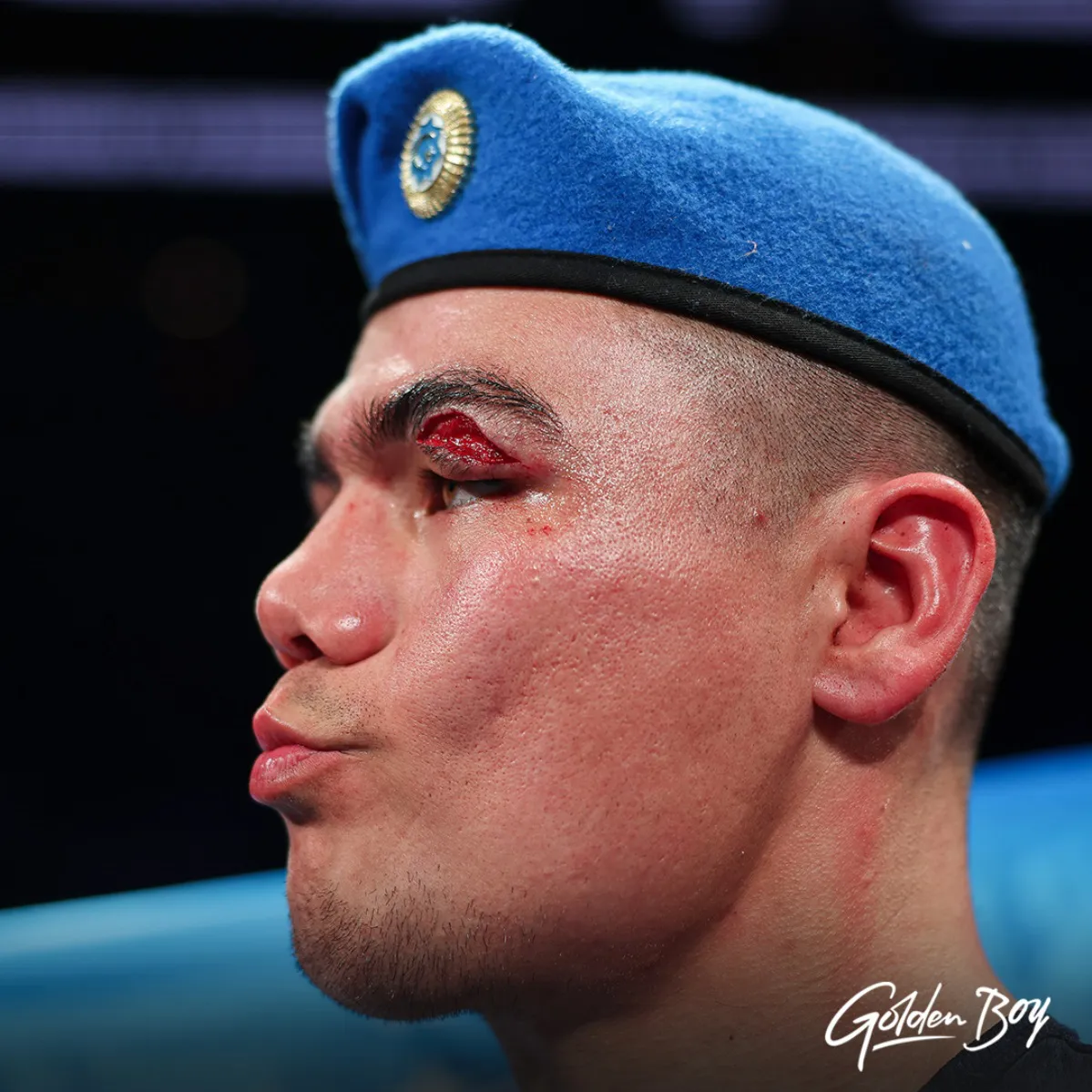 MelikuzievDibombeResultadoGBP-4